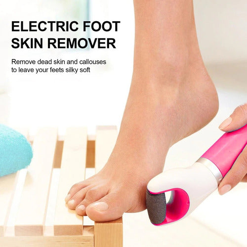 Pumice Stones Take 20 Minutes and Leave Callouses Half-Finished — The Electric Remover That Does It in 5 SBDS WORD