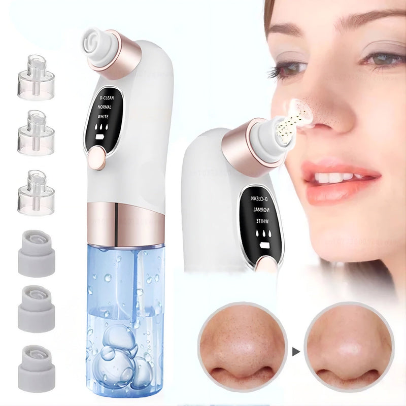 Pore vacuum cleaner blackhead remover with adjustable suction levels for extracting blackheads and sebum plugs from nose cheeks and chin — modern skin care solution Canada SBDS WORD