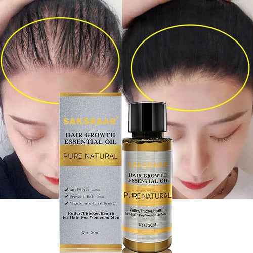 Hair Growth Serum Oil — Strengthens Follicles and Reduces Hair Thinning for Thicker Fuller Hair