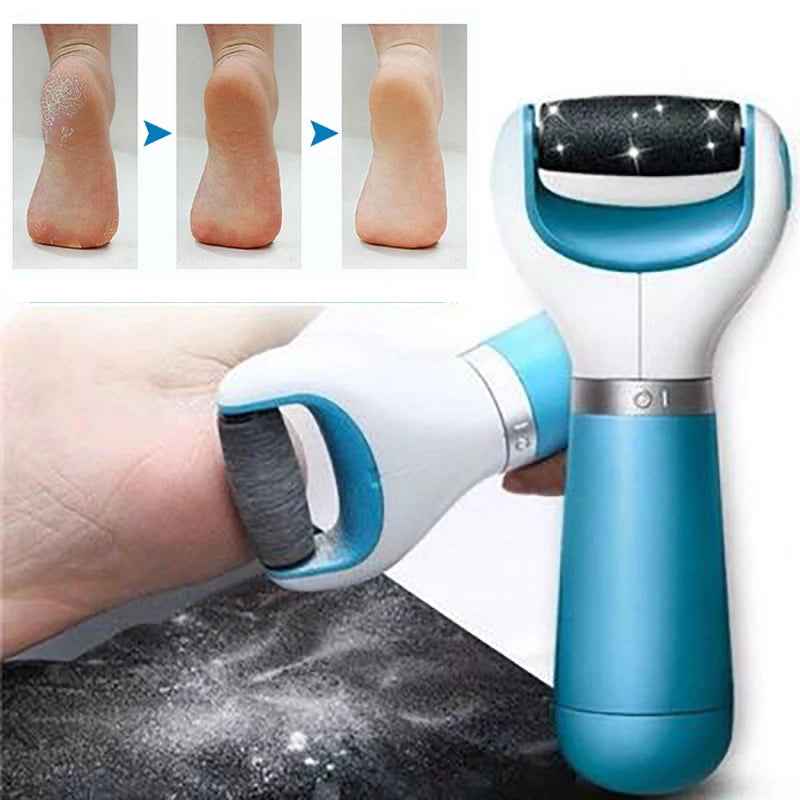 Electric Foot Callous Remover — Removes Dead Skin and Hard Callouses for Smooth Feet at Home