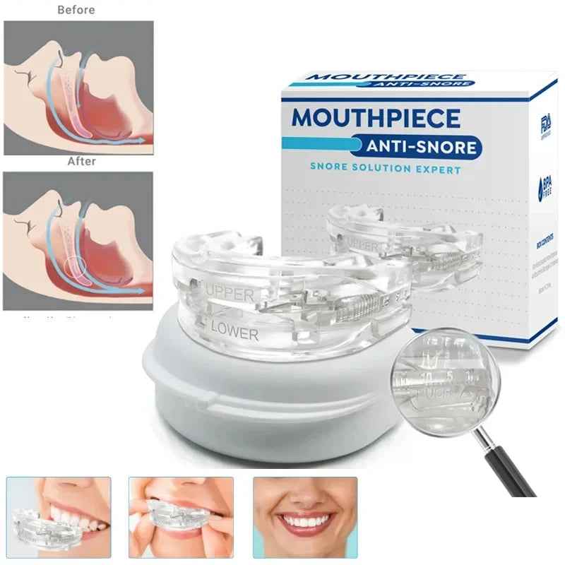Anti - Snoring Mouth Guard - SBDS WORDTR-7433anti - snoringmouth - guardsleep - aid