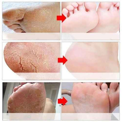 Exfoliating Foot Peel Mask 3-Pack — Remove Dead Skin for Baby-Soft Feet in One Week