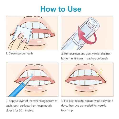 Teeth Whitening Pen Set — Professional Whitening Gel in 2 Pens for Instant Bright Smile
