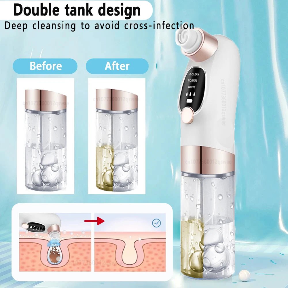 Pore Vacuum Cleaner Blackhead Remover - SBDS WORDTR-10351blackhead removerfacial carepore cleanser