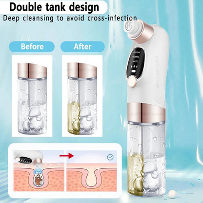 Pore Vacuum Cleaner Blackhead Remover - SBDS WORDTR-10351blackhead removerfacial carepore cleanser