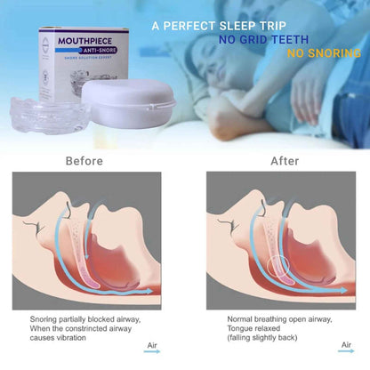 Anti - Snoring Mouth Guard - SBDS WORDTR-7433anti - snoringmouth - guardsleep - aid