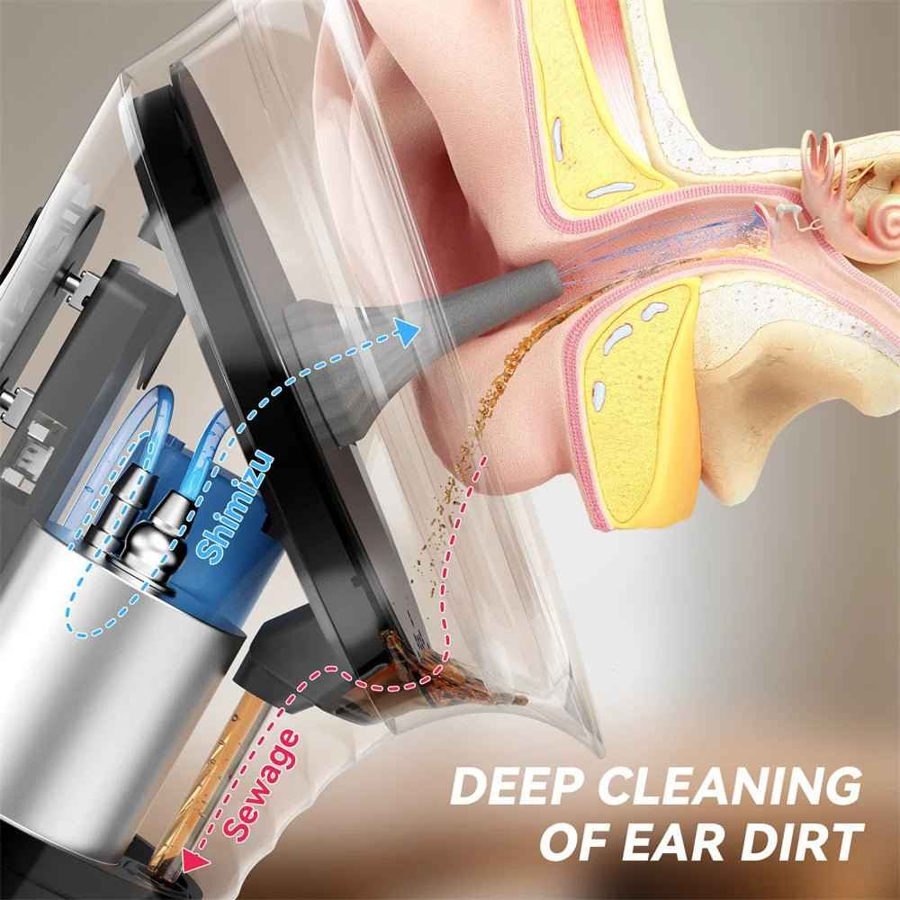 Ear Wax Water Flusher - SBDS WORDTR-10649ear cleanerear irrigationear wax removal