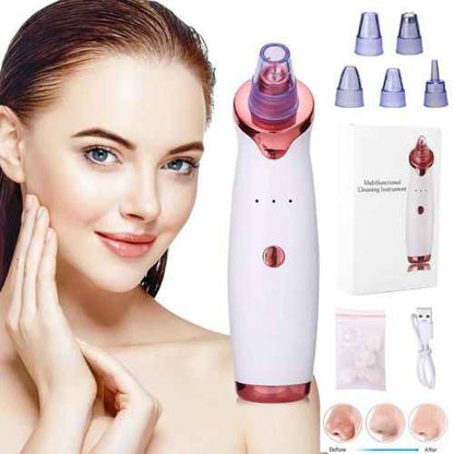 Blackhead Removal Suction Tool — Manual Vacuum Extractor for Deep Pore Cleansing Without Chemicals