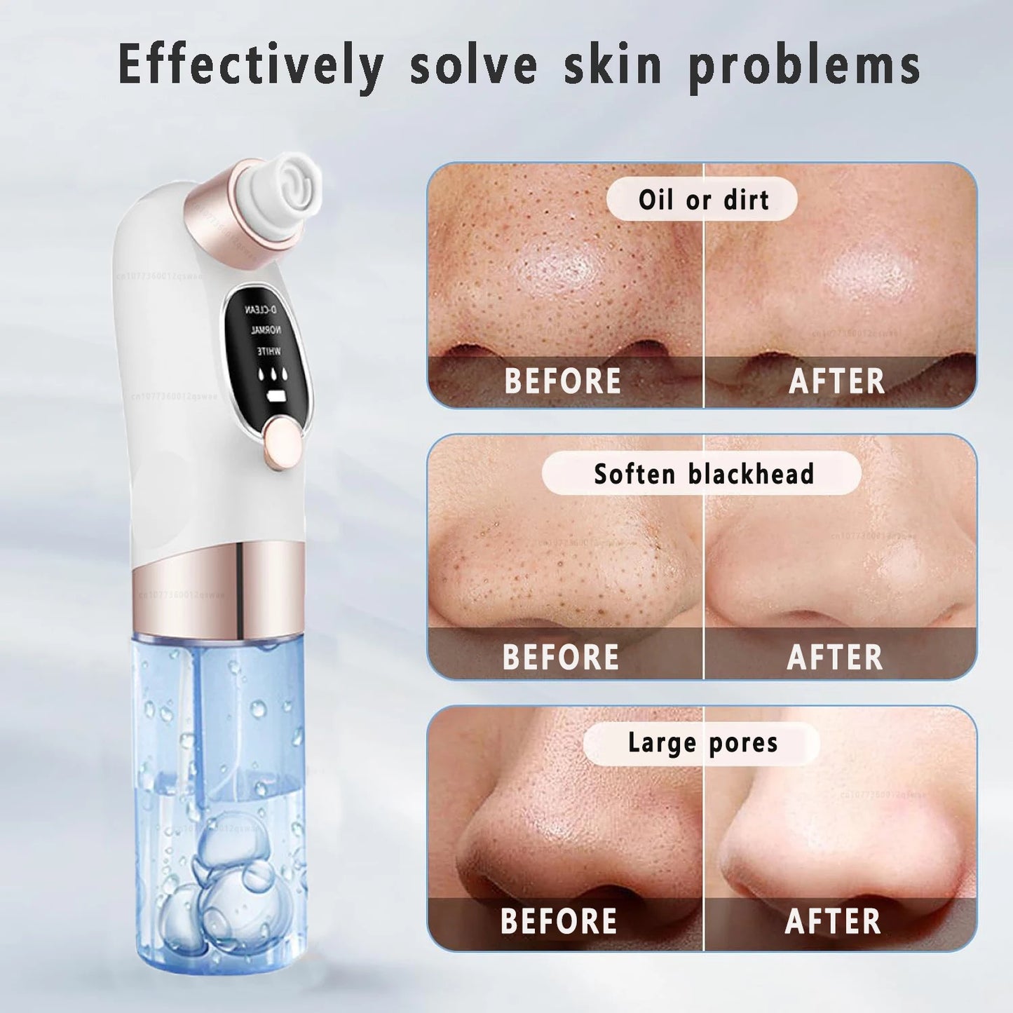 Pore Vacuum Cleaner Blackhead Remover - SBDS WORDTR-10351blackhead removerfacial carepore cleanser