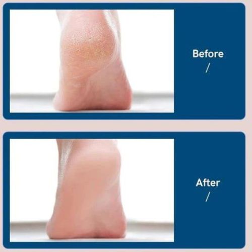 Electric Foot File SBDS WORD