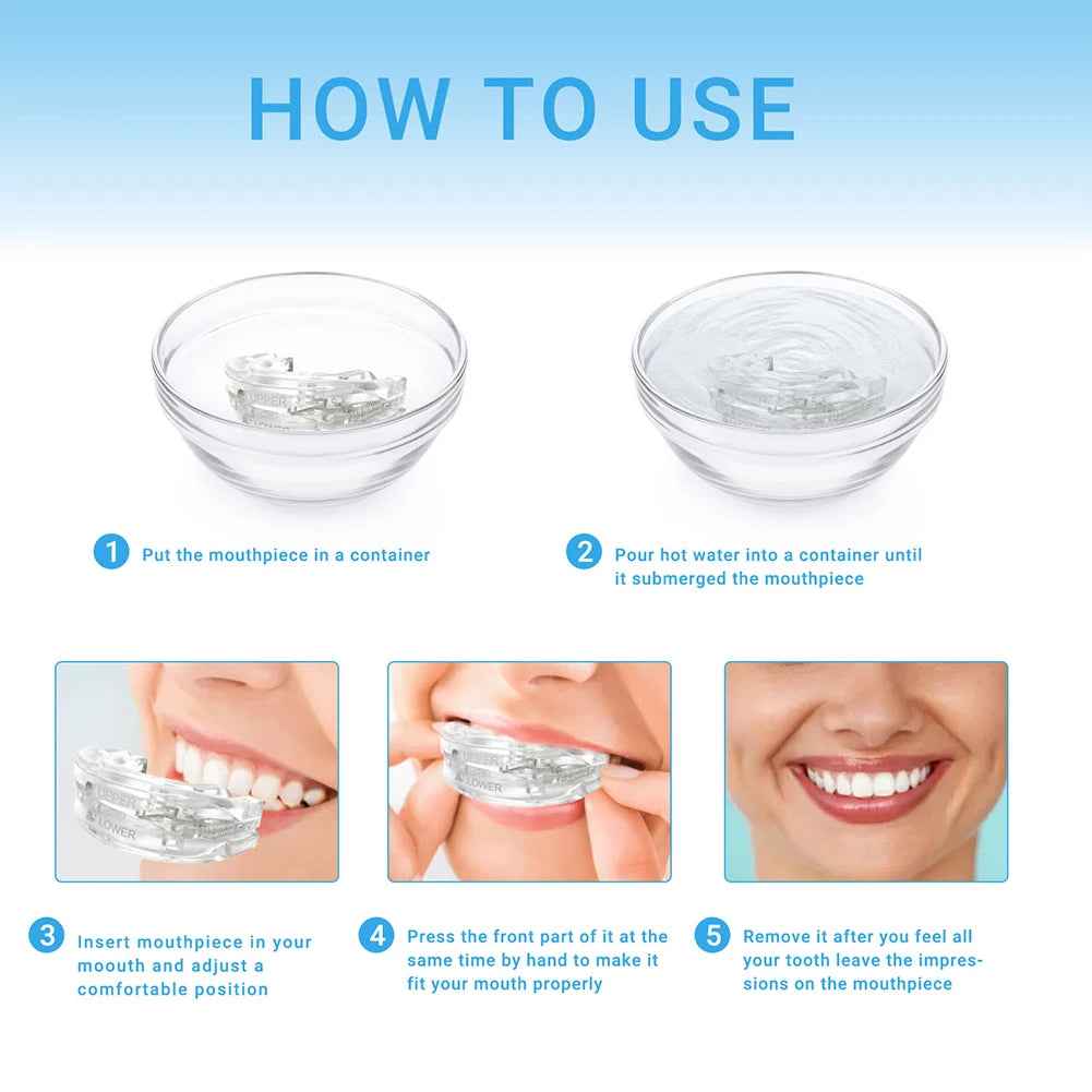 Anti - Snoring Mouth Guard - SBDS WORDTR-7433anti - snoringmouth - guardsleep - aid