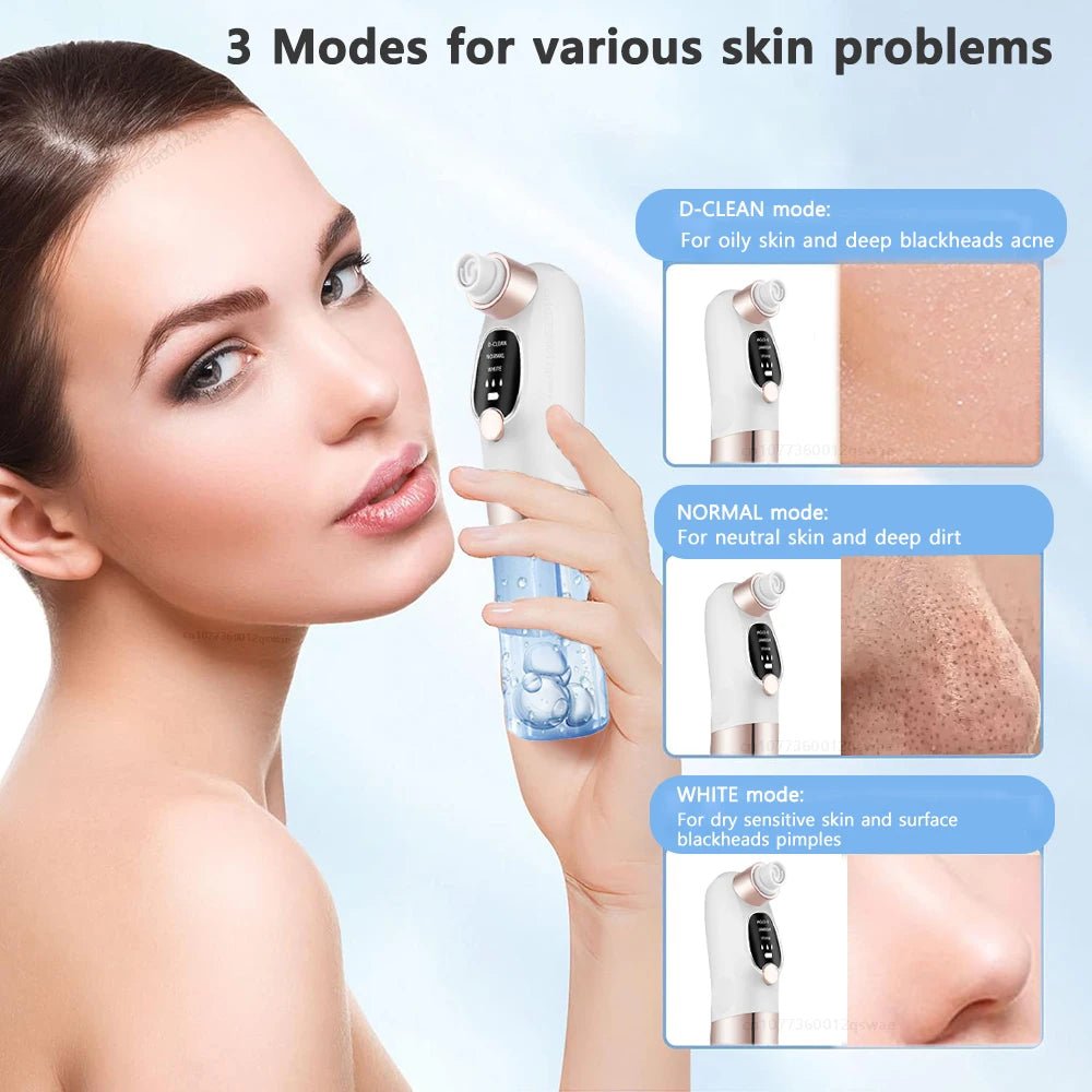Pore Vacuum Cleaner Blackhead Remover - SBDS WORDTR-10351blackhead removerfacial carepore cleanser
