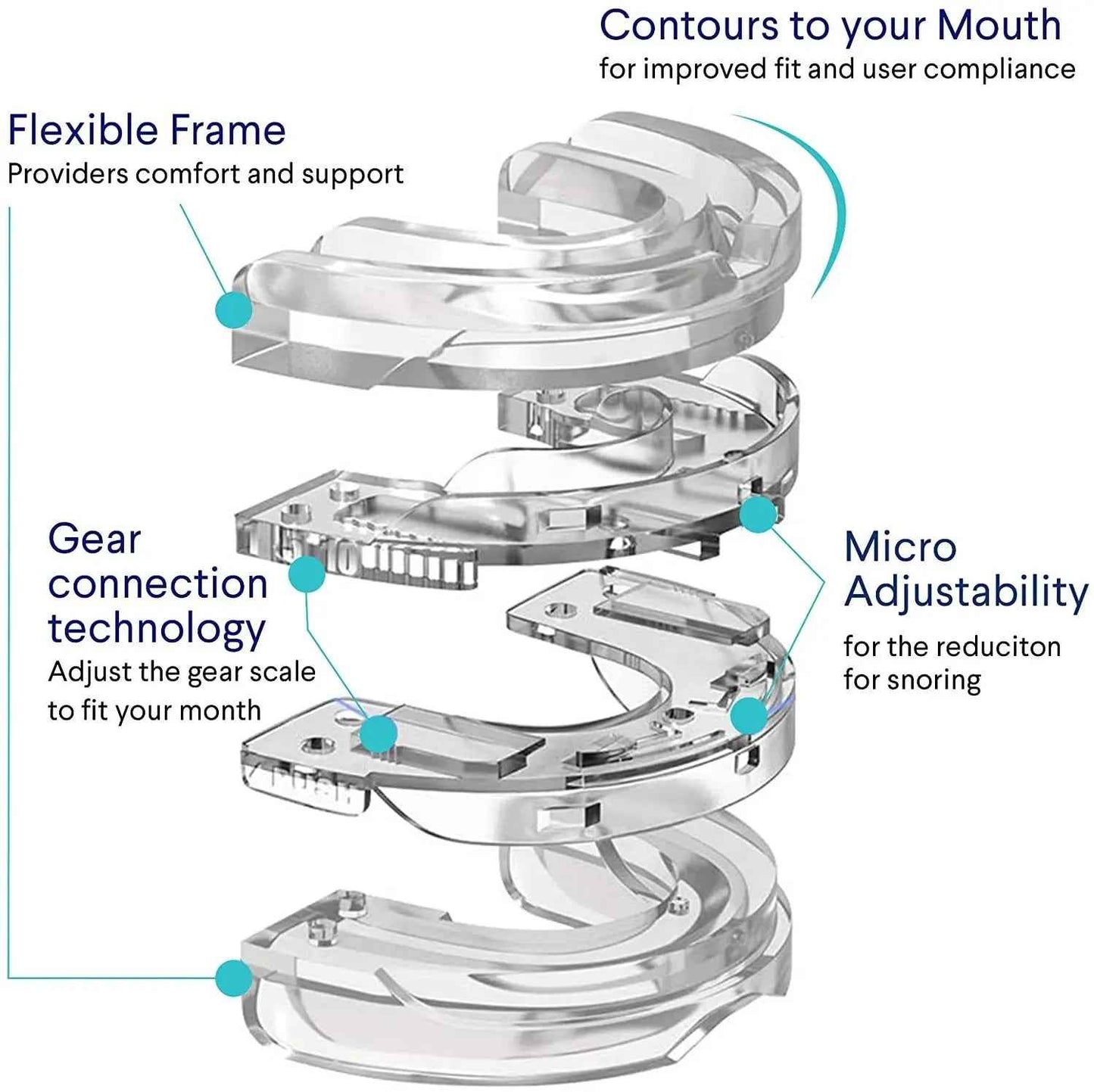 Anti - Snoring Mouth Guard - SBDS WORDTR-7433anti - snoringmouth - guardsleep - aid