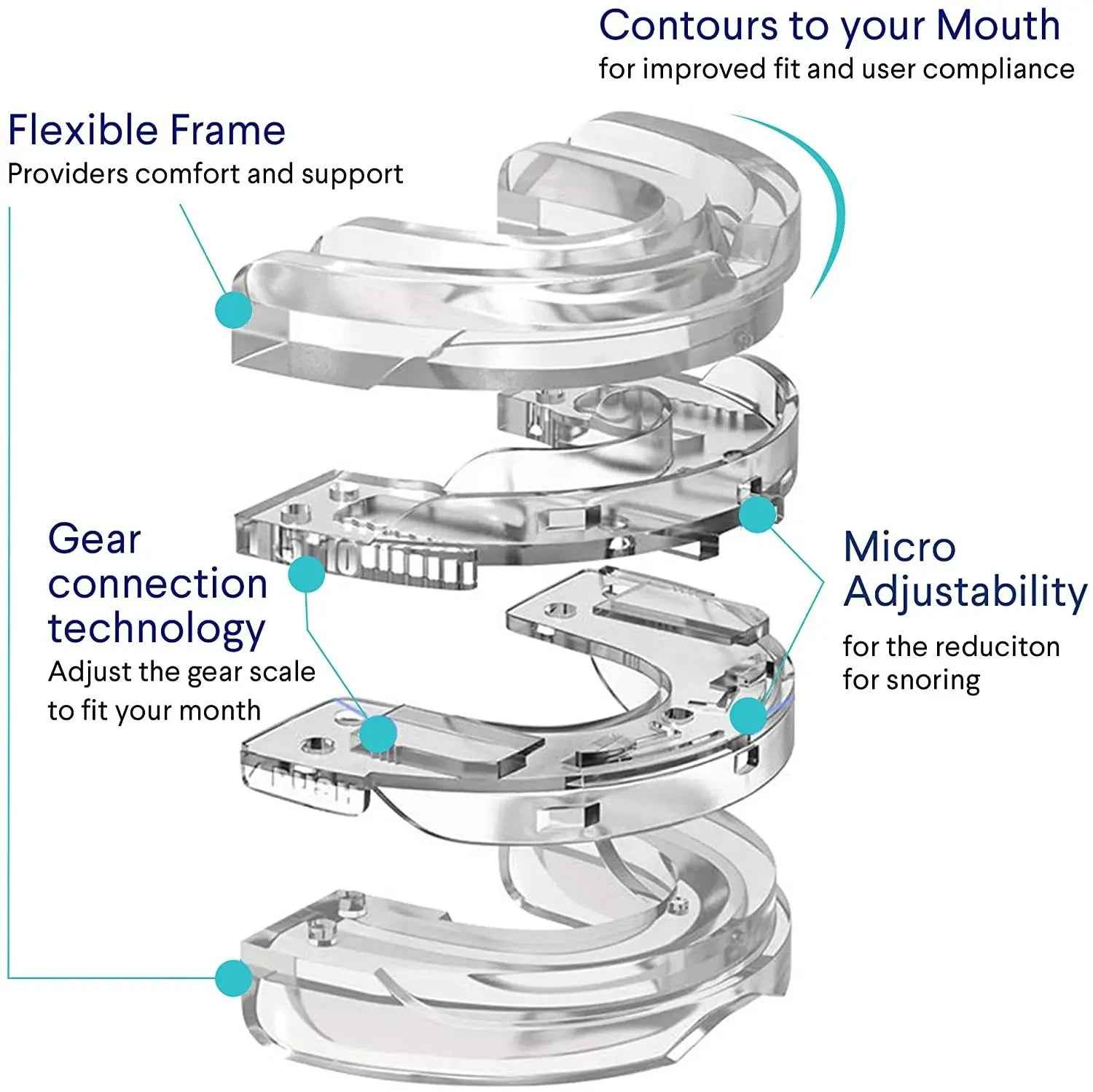 Anti - Snoring Mouth Guard - SBDS WORDTR-7433anti - snoringmouth - guardsleep - aid